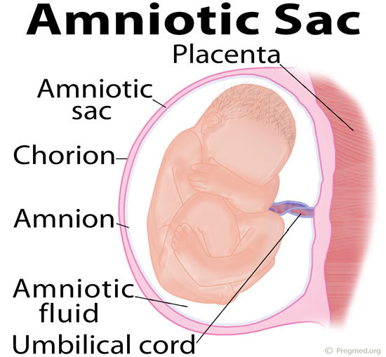 Diagram of amniotic sac: placenta. Amniotic sac, chorion, amnion, amniotic fluid and umbilical cord all labelled on the diagram of a baby in the womb.