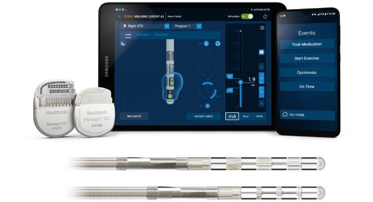 Image of component parts for Brainsense adaptive deep brain stimulation technology